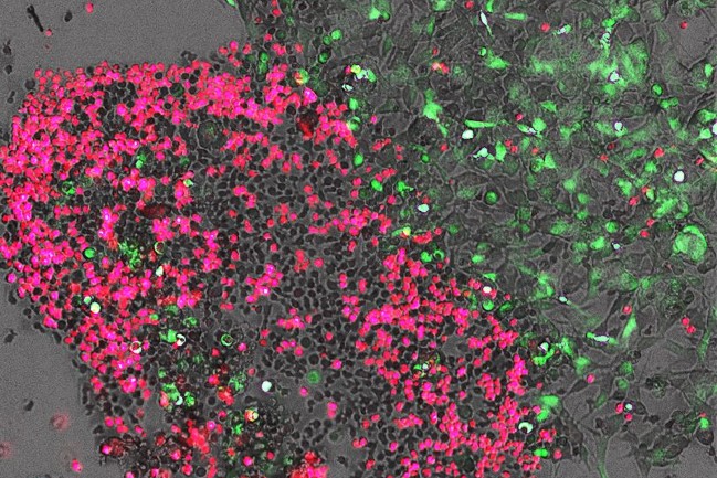 fluorescent image of killer cells attacking neuroblastoma cells